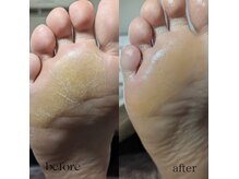 プレヴナンス(Prevenance)