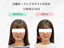 ウェリナ 一宮院/小顔矯正/骨盤矯正/痩身整体