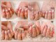 ムーピーネイル(moopy nail)の写真