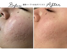 アリュール 倉敷(ALLURE)