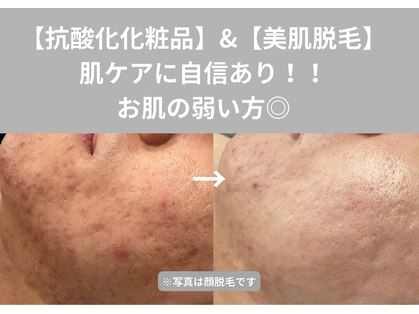 ヴィセラ(Vicella)の写真