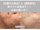 ヴィセラ(Vicella)の写真