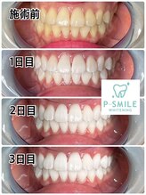 ホワイトベース(White Base)/お客様の施術後