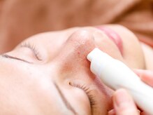 デジール/メンズ毛穴洗浄吸引＋ピーリング