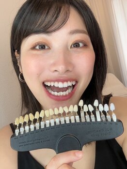 ライトビューティー 恵比寿店(LightBeauty)/綺麗な歯で素敵な笑顔に☆