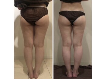 美人バスト 川崎店/【痩身・ダイエット】 川崎/脚☆