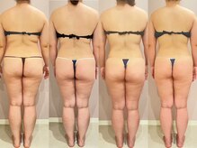 スローティ ラテ 旭川店/代謝UP！引き締め◎圧倒的効果！