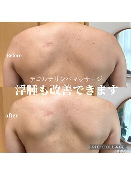 リモナ(Re-mona..)/【浮腫除去】デコルテリンパケア