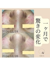 ベルーテ 田町三田(Bellute)/1ヶ月でもここまでの変化★