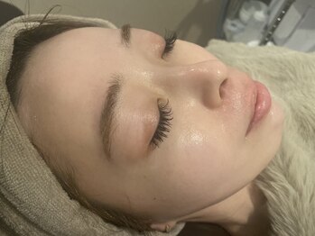 アンドエピ(&epi)の写真/【スペシャル毛穴ケアプラン】黒ずみ/頑固な角栓もごっそり除去◎土台を整え,肌荒れしにくい素肌を叶える◎