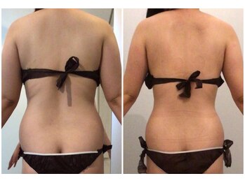 カリーナ(Carina)/ブライダルの方も多数!