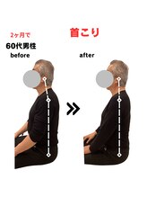 ライフタイムビューティー 梅田中崎町店(Life Time Beauty)/60代男性　無理せず肩こり改善！