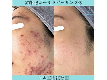 リメイククリニカルビューティー(Remake clinical beauty)/