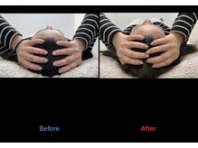 レヴィタンス カゴシマ(LEVITANCE kagoshima)/顔まわりスッキリ！