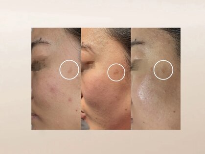 ルンルン(run run)の写真