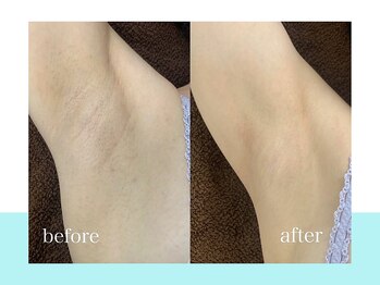 スキンラボ ドットシキブ 厚木海老名店(skinlabo .sikibu)/毛穴レスなお肌へ