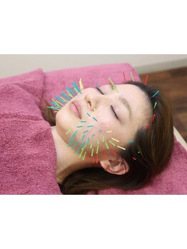 鍼灸施術を受けたい