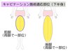 【痩身|下半身集中】キャビテーション+美骨盤矯正(広々3部位下半身カバー◎)