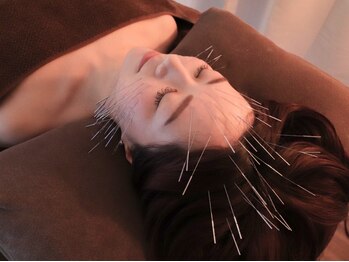 けんたろう鍼灸院の写真/速効性が高く話題の鬼美容鍼!1度受けたら他にはいけない。リピーター続出のルート鍼が大人気◎