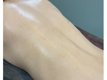 ミセルラボラゾ 久留米店(Misel Labo Lazo)/BeforeAfter