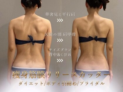 リノ(Lino)の写真