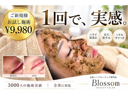 ブロッサム(Blossom)の写真