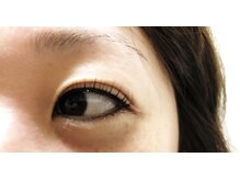 フェアリーヘア ニーナ(Fairy Hair Ni-na)/まつ毛パーマ【ラッシュリフト】