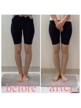 スタイルラボ高松/産後骨盤矯正の効果♪