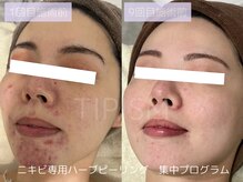 ハービー(Herbee)/鏡を見るのが楽しく