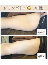 チャルム(CAL'ME)/レモンボトル・二の腕　