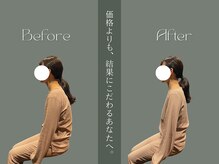 巡 金山店(MEGURI)/猫背改善