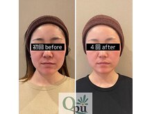 キュープ 鹿児島伊集院店(Qpu)/