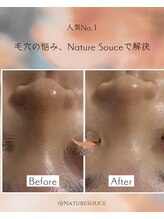 ナチュラ ソース(NatureSouce)/黒ずみ・毛穴
