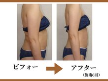 リラモ 布施本店(RELAMO)/40代からの落ちにくい脂肪に特化