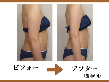 リラモ 布施本店(RELAMO)/40代からの落ちにくい脂肪に特化