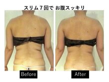 ナチュラーレ 天王寺店(Naturale)/痩身美脚リンパマッサージ二の腕