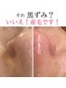 【ムダ毛・透明感が気になる方へ】産毛、古い角質もオフして素肌から発光