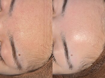 ルーナジェーナ(Luna llena)/池袋 エステ ルーナジェーナ