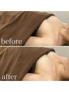 ビュエル(Beauel)/D→E/2ヶ月で1カップup/3回目