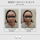 アンジュロワール
