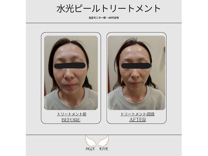 アンジュロワールの写真