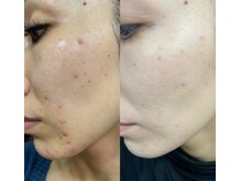 メリーオーシャンズ(merry ocean’s)/モリーズプロ取扱店