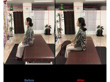 ストレチックス 近江八幡店/姿勢改善ビフォーアフター1回