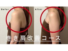 巻き肩改善コース〈首肩こり〉〈頭痛〉〈腕痛み〉