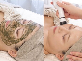 ココット 板橋(kokotto)の写真/【ニキビケア人気No1】肌質改善ハーブピーリング×ニキビ改善プラズマ照射￥14300→￥11000