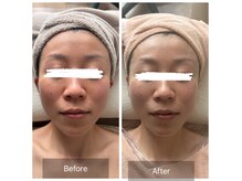 エメカシワ(Aimer KASHIWA)の雰囲気(【ハイパーナイフEX2フェイシャル】小顔リフトアップ☆)