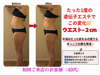 エーシーサロン 六本木店(acsalon)/前ももの張りも1度でスッキリ♪