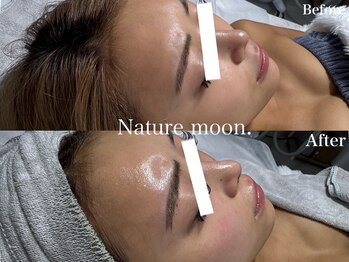 ナチュールムーン(Nature moon.)/ピーリング