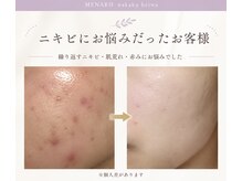 メナードフェイシャルサロン 中区平和