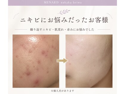 メナードフェイシャルサロン 中区平和の写真